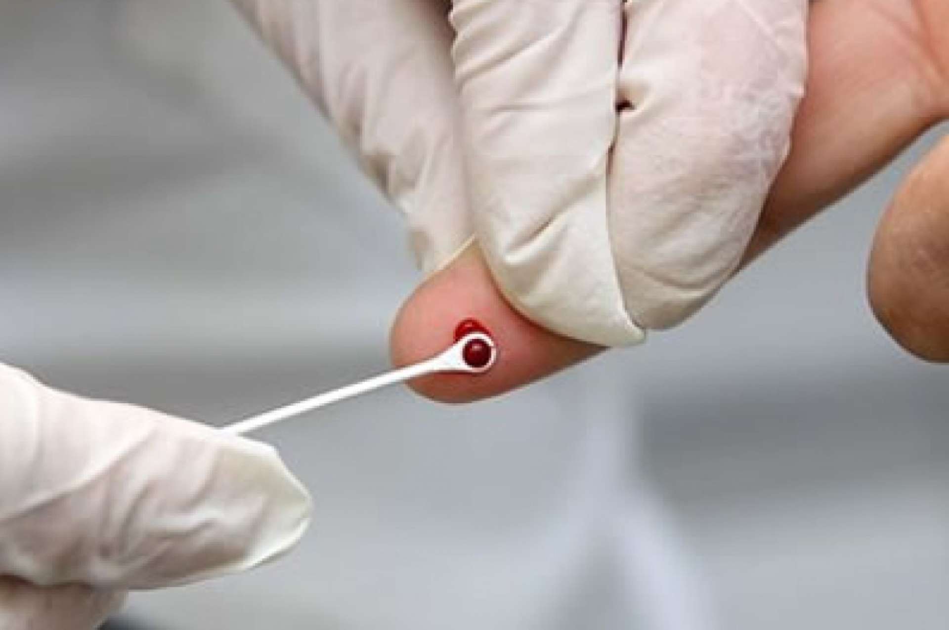 Testes de VIH e hepatites nas farmácias sem necessidade de prescrição médica
