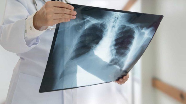 ULS de Castelo Branco investe 700 mil euros em Tomografia Axial Computadorizada no Serviço de Imagiologia